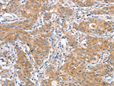 ATG12 Antibody