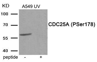 Phospho-CDC25A (Ser178) Antibody