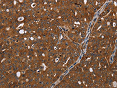 HDAC7 Antibody