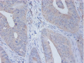 IL12B Antibody