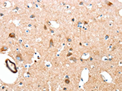 AARS Antibody