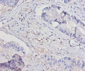IL15 Antibody