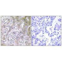 ACOT12 Antibody