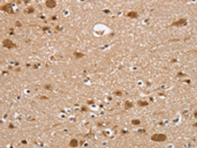 RUNX1T1 Antibody