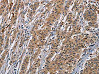 AGER Antibody
