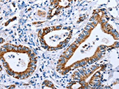CPT1A Antibody
