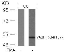 Phospho-VASP (Ser157) Antibody
