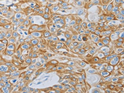 MC5R Antibody