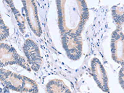 ACTR3B Antibody