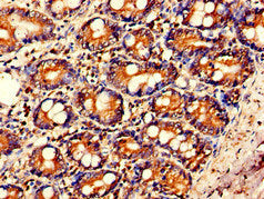 IL23A Antibody