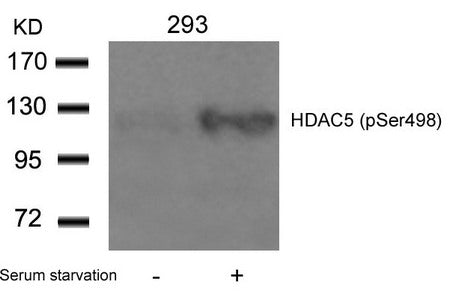 Phospho-HDAC5 (Ser498) Antibody