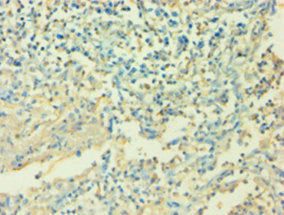 IL6 Antibody