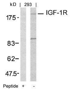 IGF1R (Ab-1161) Antibody