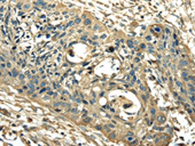 PKM Antibody