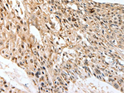 SLC1A7 Antibody
