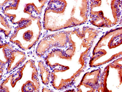 KLK3 Antibody