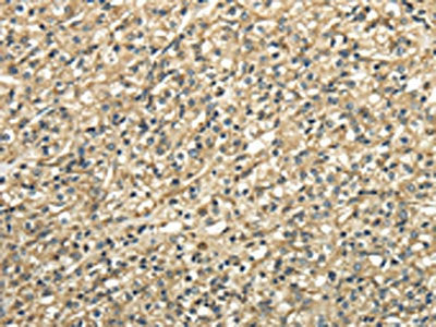 TUBA1C Antibody