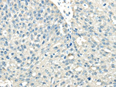 VPS36 Antibody