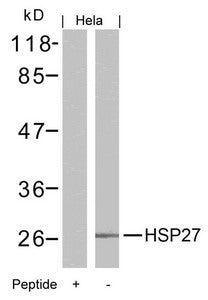 HSPB1 (Ab-15) Antibody