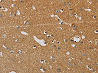 KIF4A Antibody
