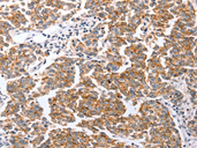 CLDN3 Antibody