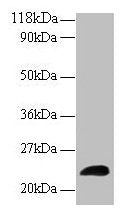 LCN2 Antibody