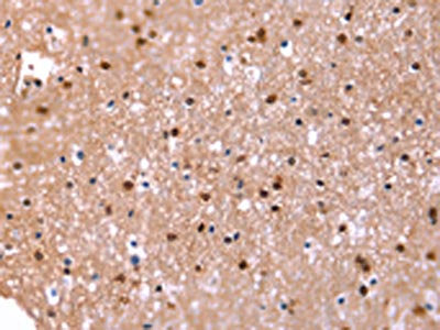 FAT1 Antibody