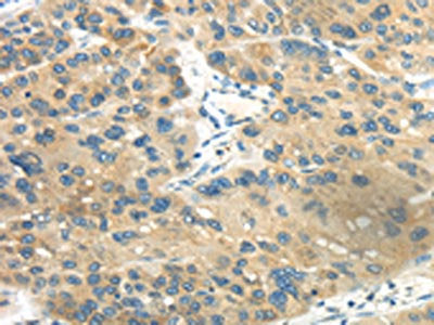 CD70 Antibody