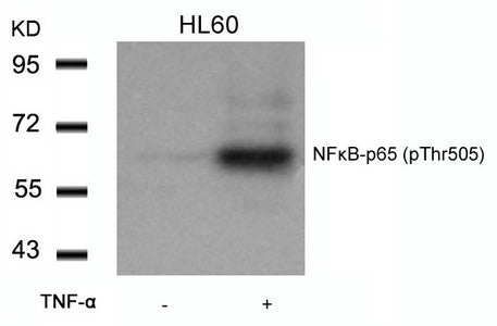 Phospho-RELA (Thr505) Antibody