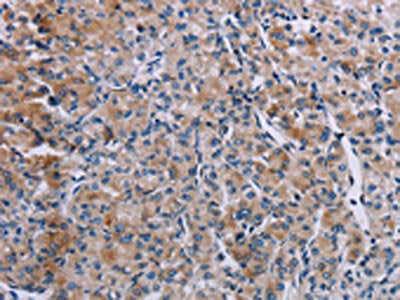 KDM4D Antibody