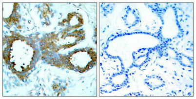 Phospho-PAK1/PAK2/PAK3 (Thr423/Thr402/Thr421) Antibody