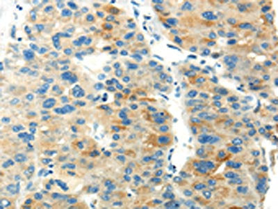 PDPN Antibody