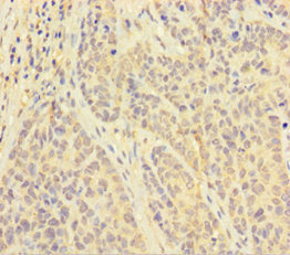 PAPPA Antibody