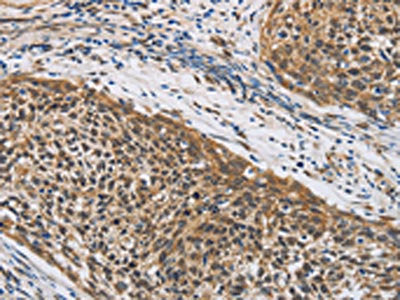 LEF1 Antibody