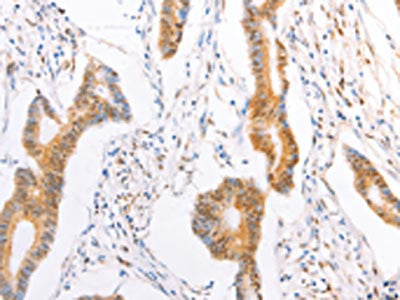 TRAF5 Antibody