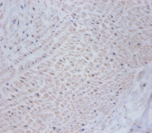 CSRP2 Antibody