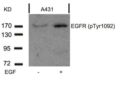 Phospho-EGFR (Tyr1092) Antibody