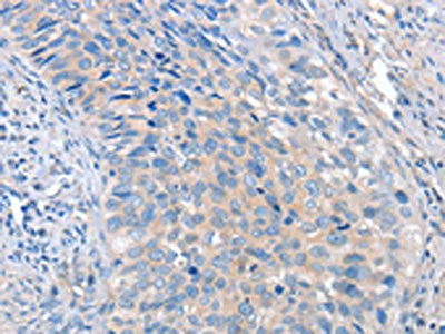 ADAM10 Antibody