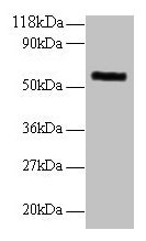 MMP1 Antibody