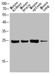 Phospho-FADD (S194) Antibody