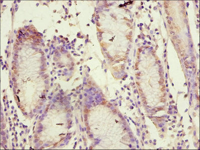 MMP10 Antibody