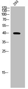Phospho-CD5 (Y453) Antibody