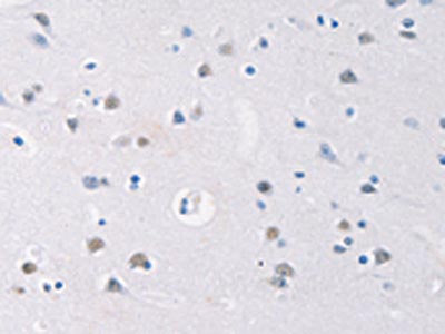 GATA4 Antibody