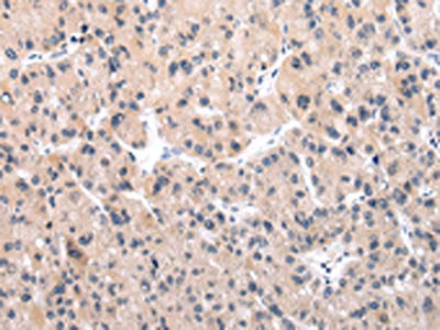 IGF1 Antibody