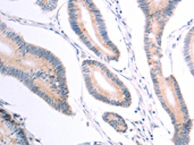 VHL Antibody