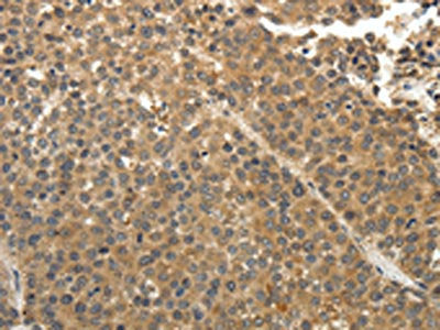 EIF2AK3 Antibody
