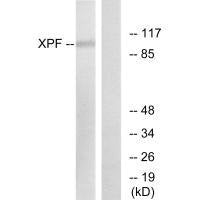 ERCC4 Antibody
