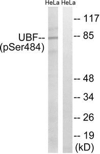 Phospho-UBTF (Ser484) Antibody