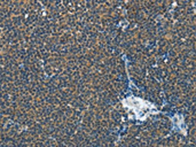 IL1R1 Antibody