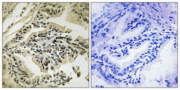 Phospho-EIF2AK3 (Thr981) Antibody